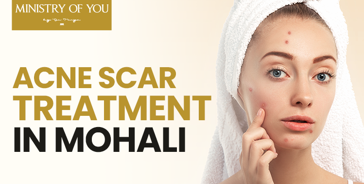 Acne Scar Treatment Mohali