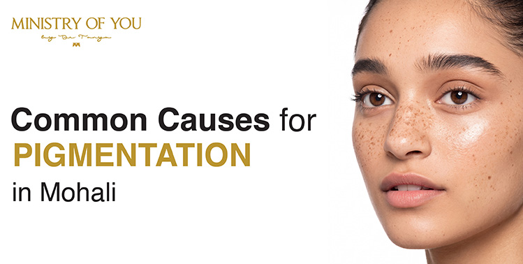 Skin Pigmentation Mohali
