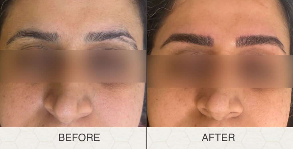 Ministry-Of-You-Before-After